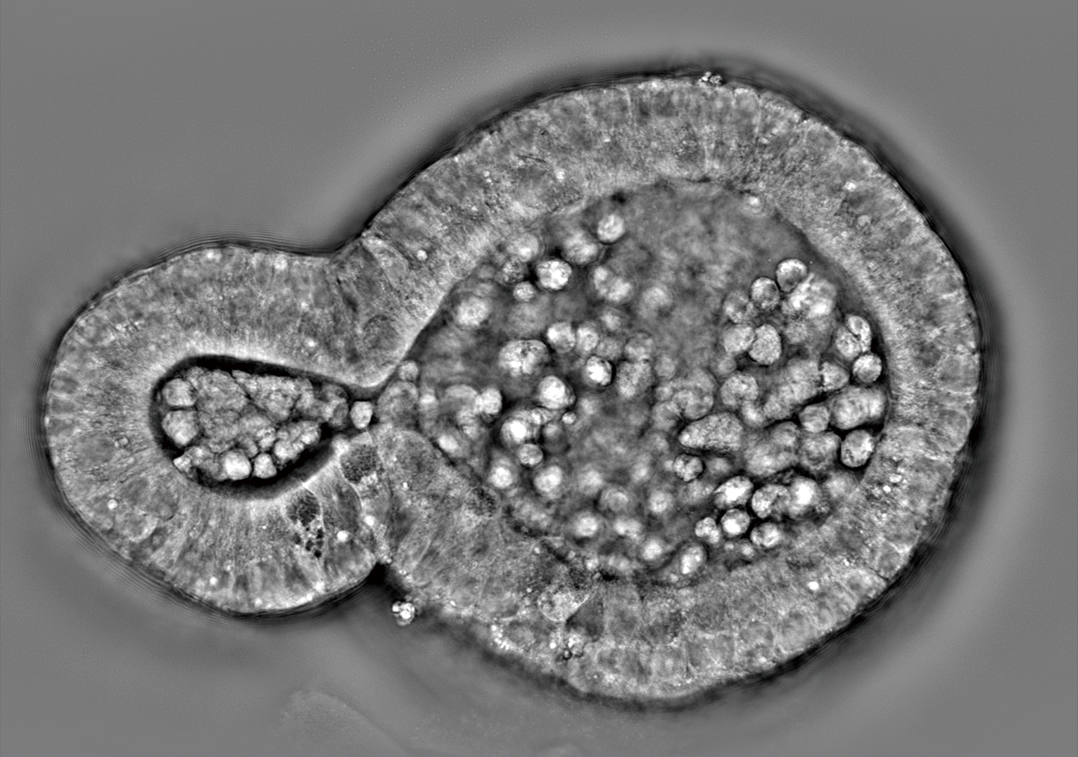 High Resolution Imaging of 3D Biological Samples.png