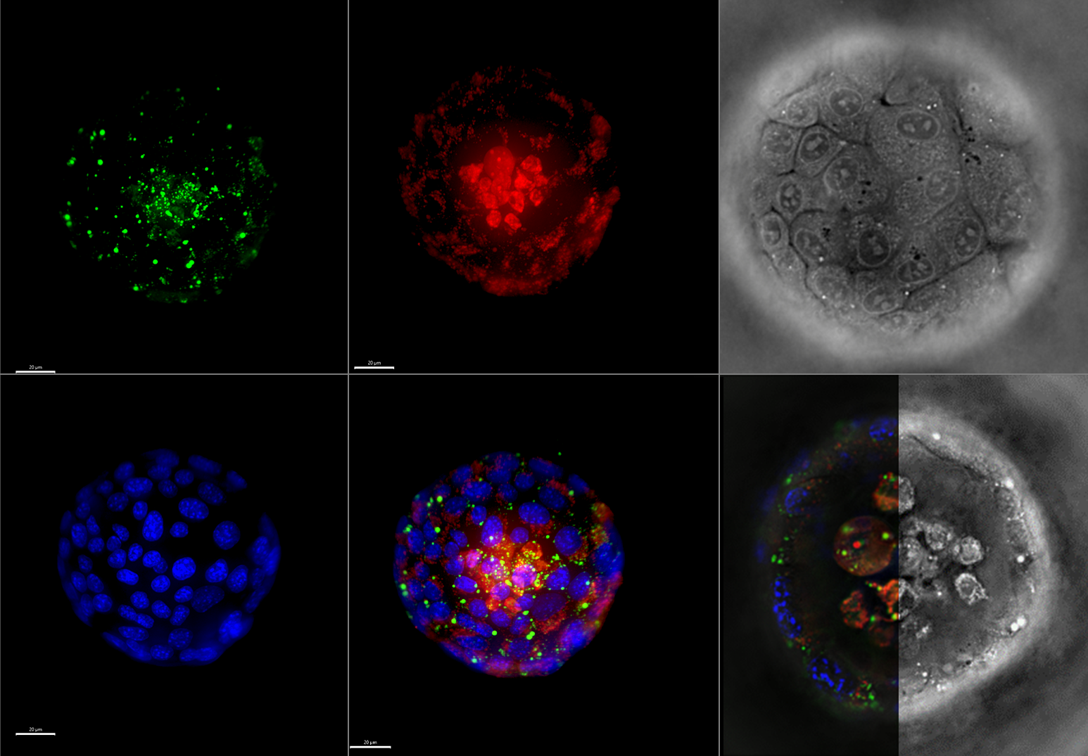 Enhanced-Correlative-Florescence.png