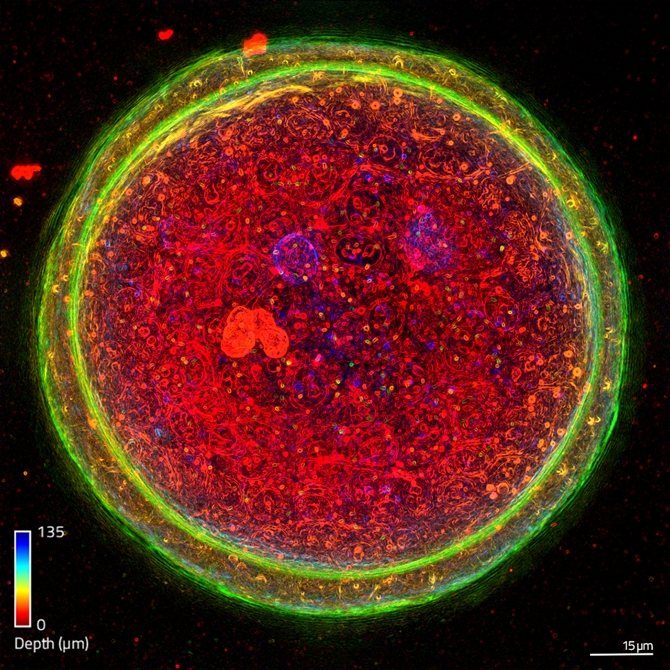 {HT-X1_Organoid_HO_01_burningraphics.png}