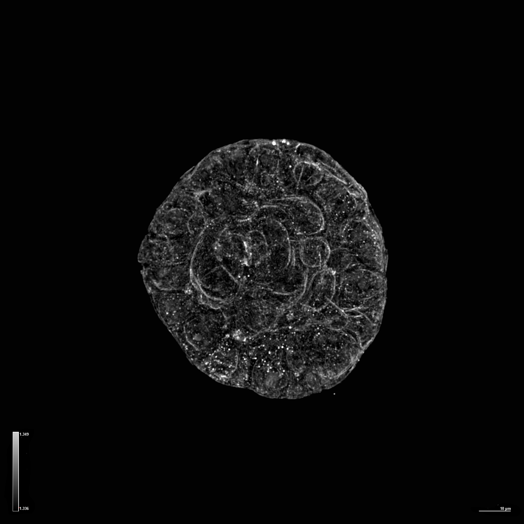 {HT-X1 Plus_Acinar spheroid_HT.png}