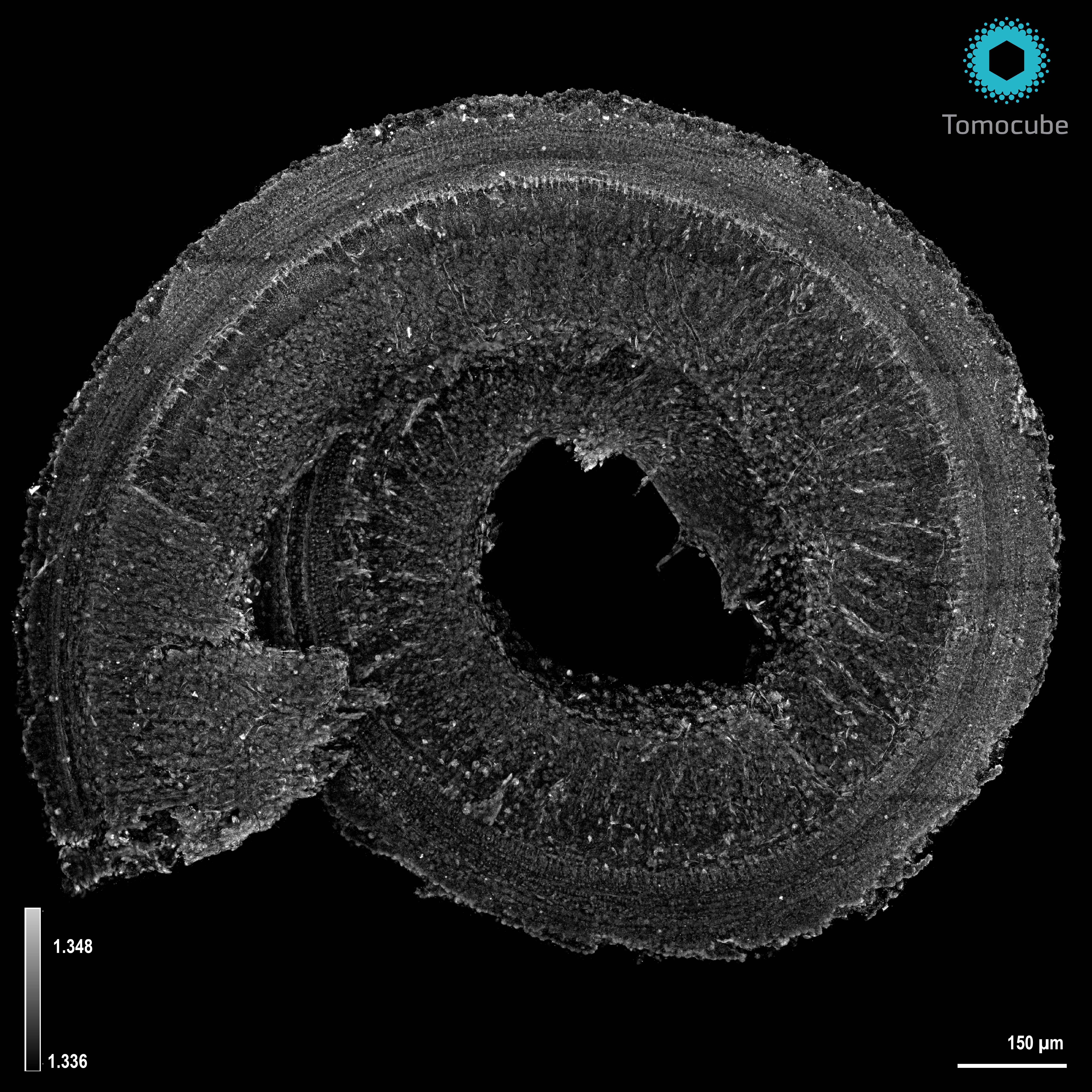 {Ear cochlea.png}