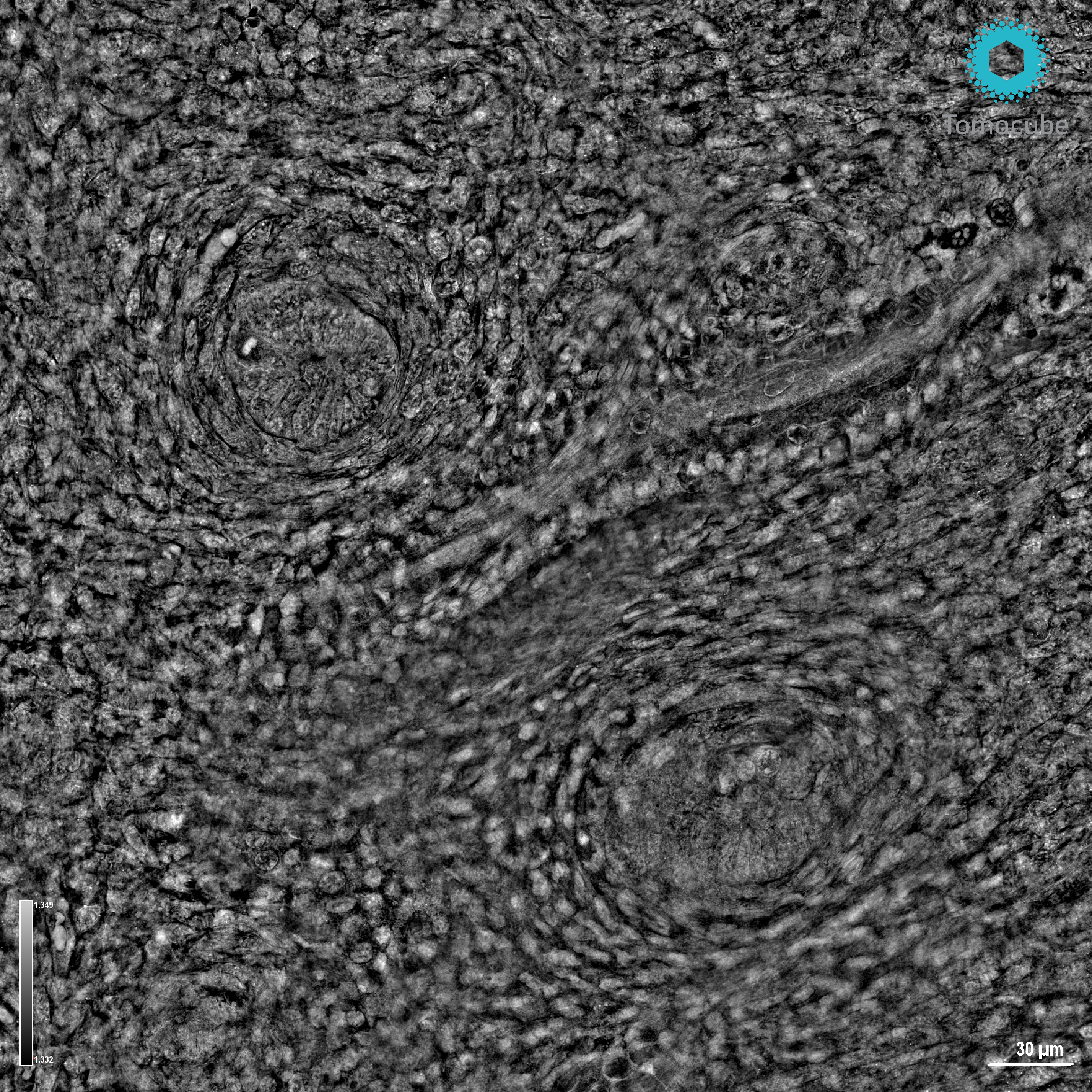 {Hair follicle_starry night_2.png}