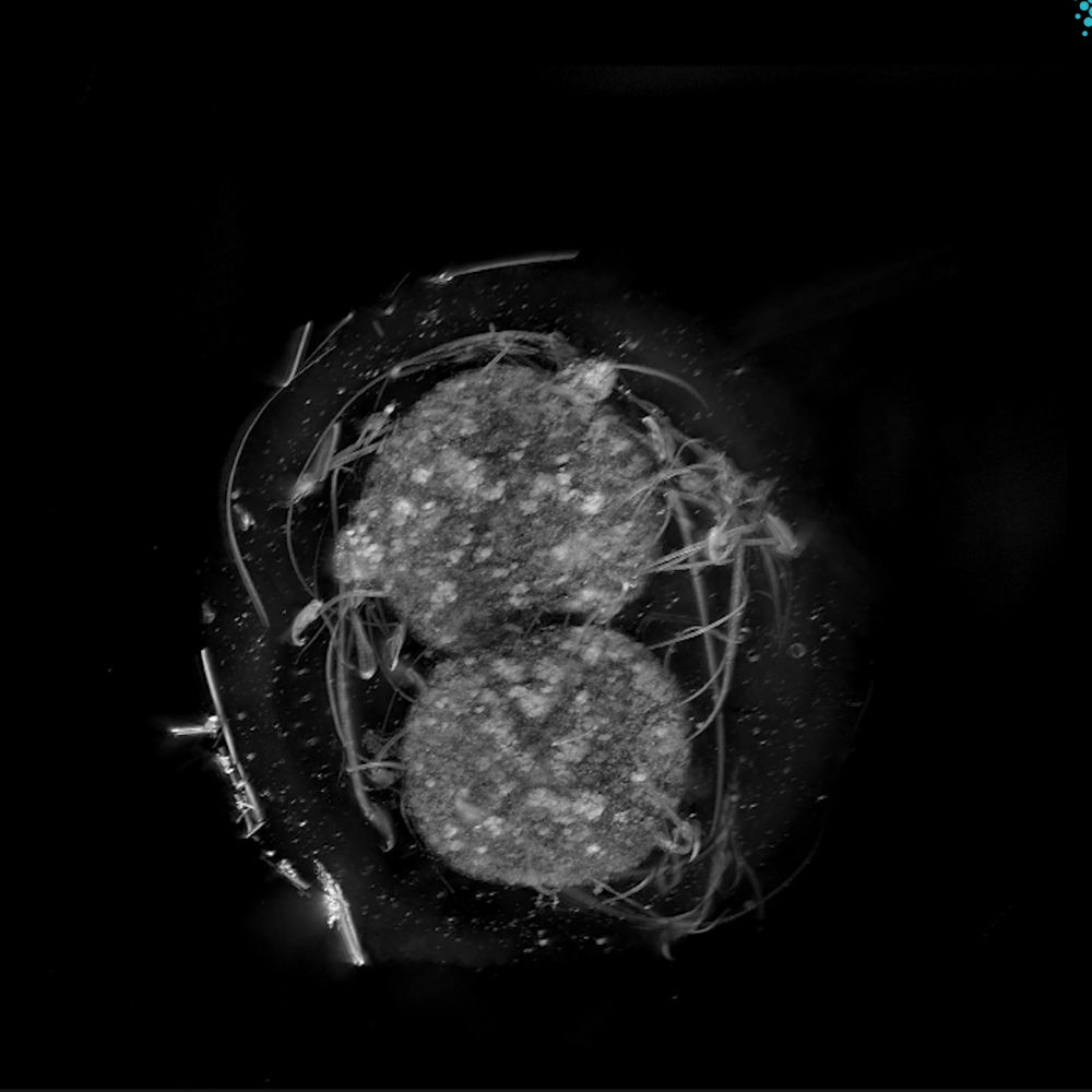 {Mouse embryo.png}
